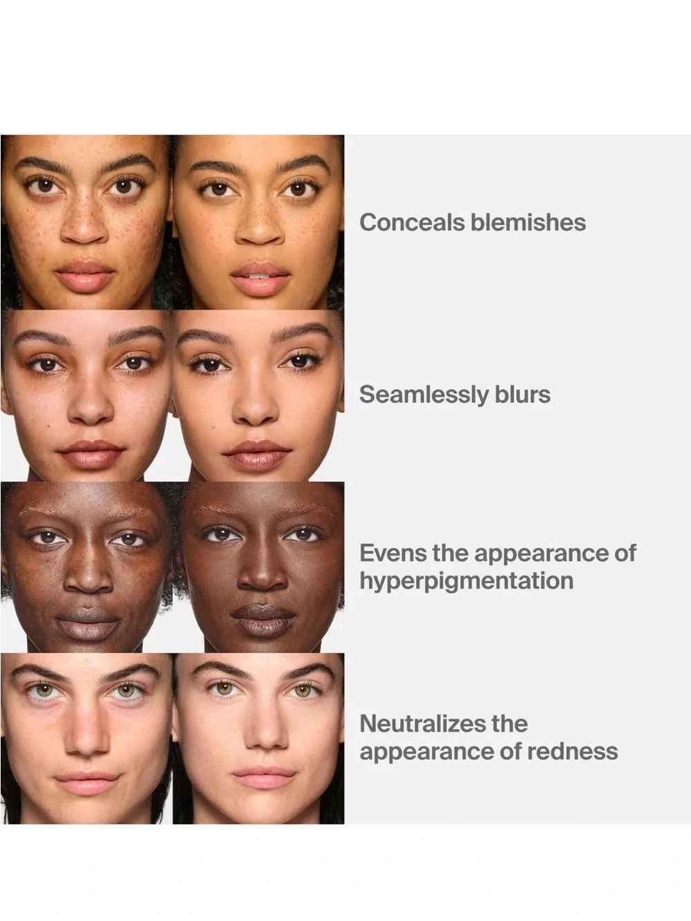 Triclone Skin Tech Medium Coverage Foundation with Fermented Arnica - Color 300